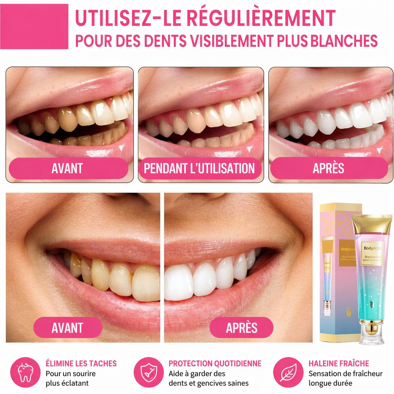 Adieu aux Dents Jaunes, Bonjour au Sourire Éclatant avec Body Accel